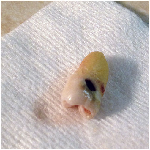 Tooth